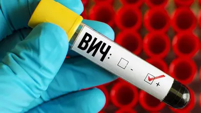 Жительница Узбекистана заразила молодого мужчину ВИЧ 