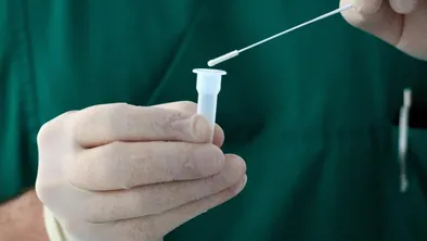 Новый штамм обезьяньей оспы обнаружили британские ученые