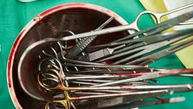 В Кокшетау мужчина пытался продать почку из-за долгов