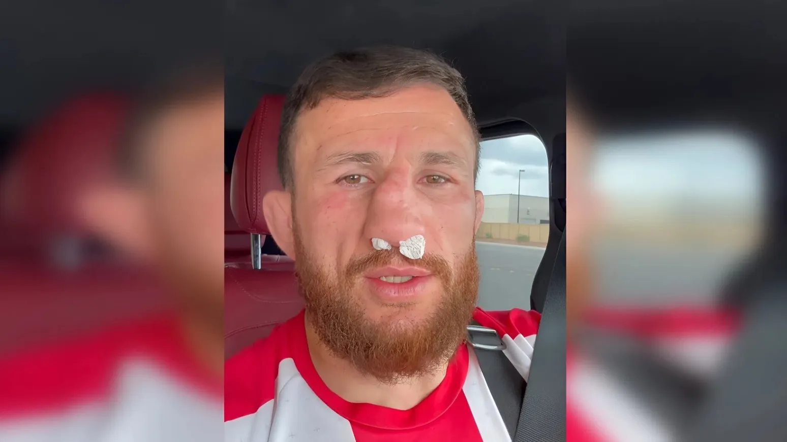 Двалишвили сломал нос в двух местах, но отказался от операции: в чем причина фото на taspanews.kz от 03 апреля 2026 14:38